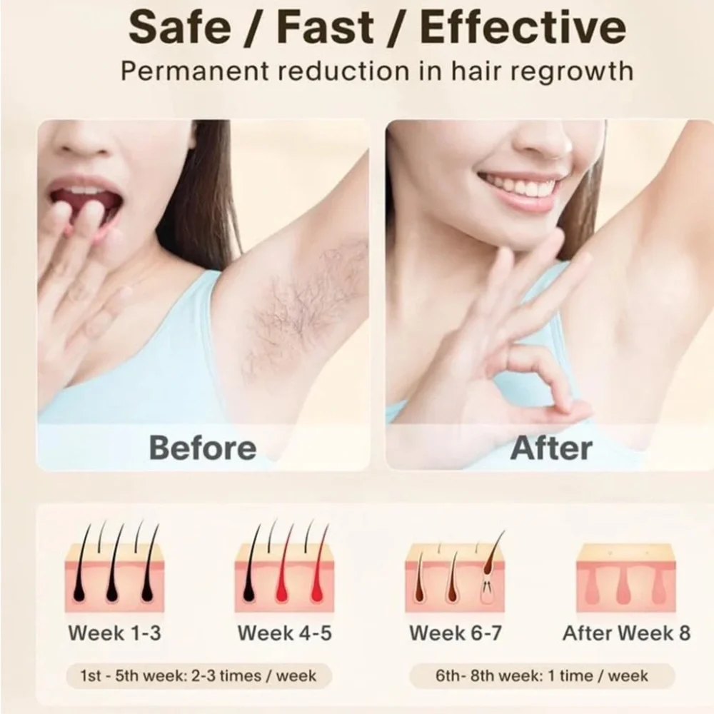 NEW Laser Hair Removal for Women and Men, Hair Removal Device for Body